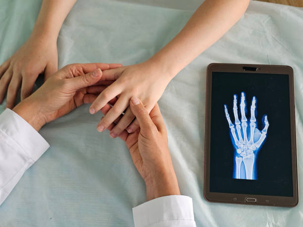 istock Doctors point to x-ray medical imaging with hand bone disease 2155298945