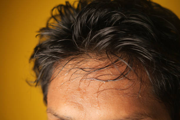 istock closeup of sweat on forehead against dark background , 2155455062