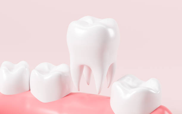 istock Human tooth model, tooth implantation, orthodontics, 3d rendering. 2155537675