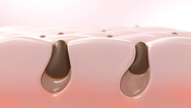 istock Blackhead clogged in pores 2155559791