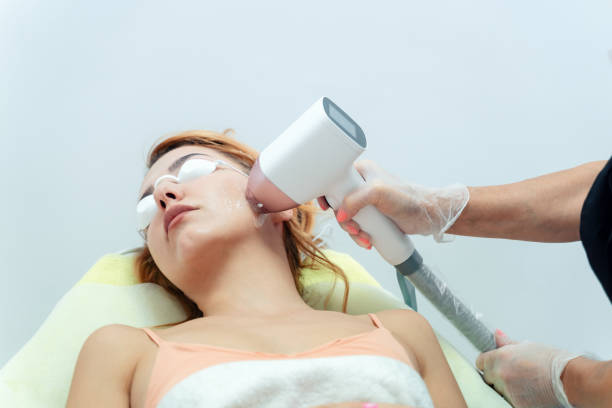 Young woman receiving a laser hair removal procedure on her face in a cosmetology center stock photo