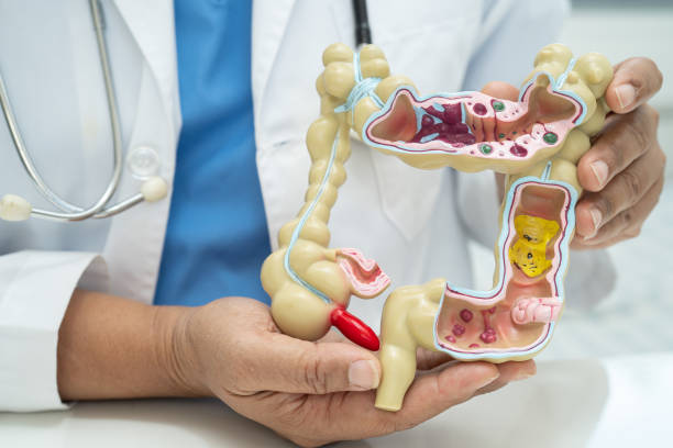 istock Intestine, appendix and digestive system, doctor holding anatomy model for study diagnosis and treatment in hospital. 2155804293