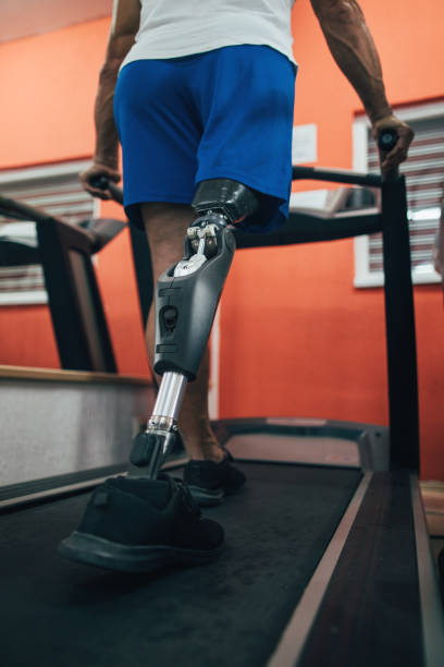 istock Close-up of an amputee's prosthetic leg 2156103772