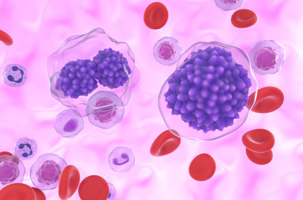 istock Plasma cell leukemia (PCL) - closeup view 3d illustration 2156142727