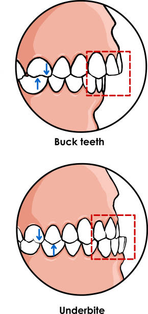 Buck Tooth Drawing 110+ Buck Teeth Stock Illustrations, Royalty-Free Vector Graphics ...