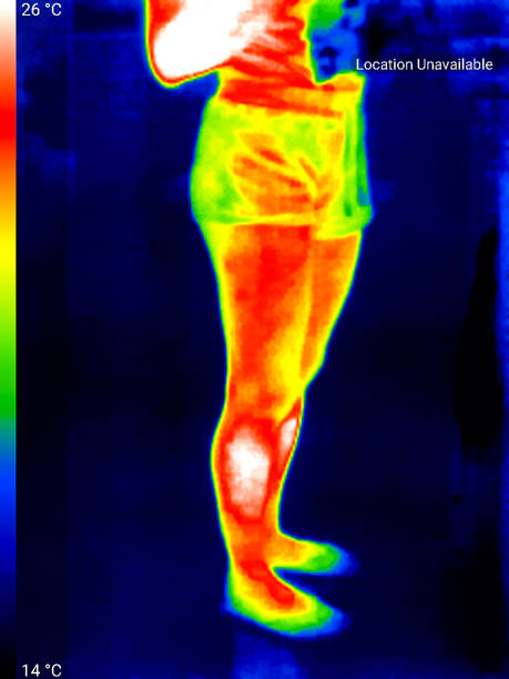 istock Thermographic photo of human body 2156366295