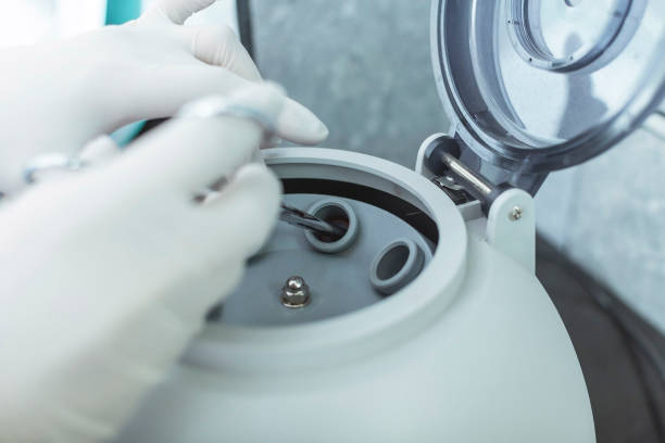 istock A lab technician removes a blood sample from a centrifuge. For hematology analysis at a laboratory. 2156633724