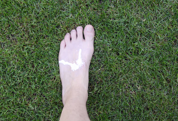 Closeup of man's foot with suntan lotion on it outdoors.