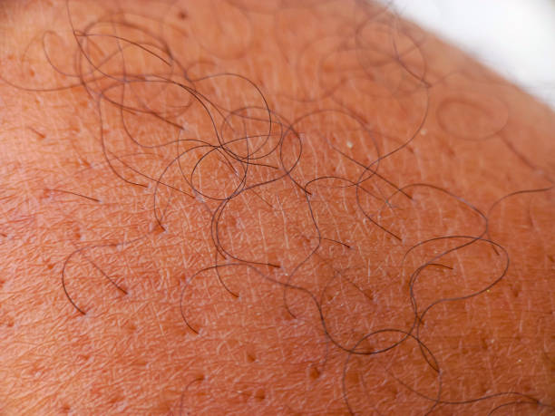 Male hand skin pores