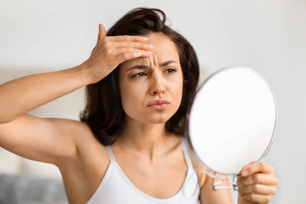 istock Upset millennial woman looking at mirror, checking pimple 2157073187