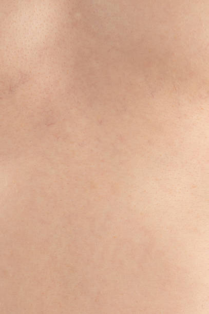 istock Clean soft cream color human skin 2157147140
