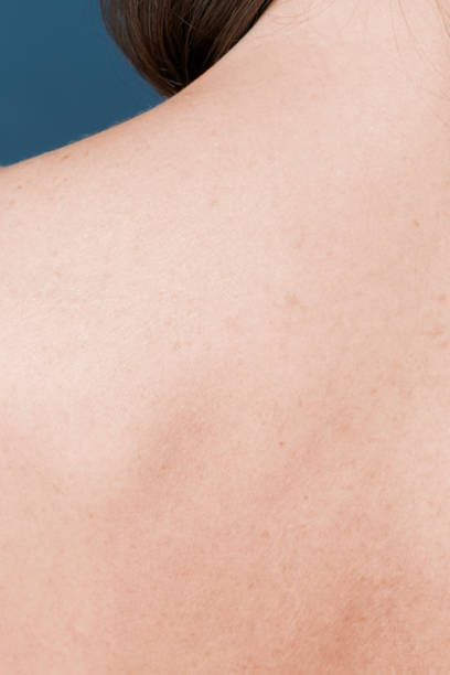 istock Rear view of woman's bare skin 2157213908