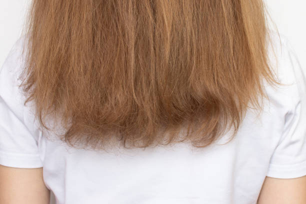 woman with damaged dry hair and split ends