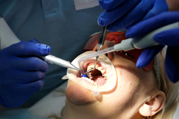 istock Professional tooth cleaning Dentist with assistant under microscope treats the patient's teeth. Modern progressive dentistry. 2157282669