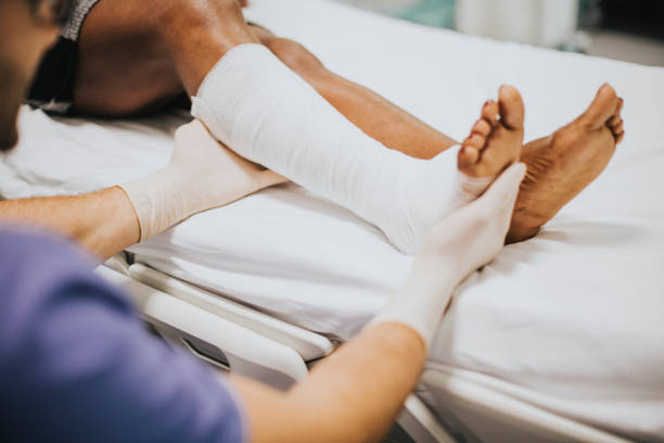 istock Doctor helping a patient with a fractured leg 2157382366