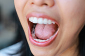 nahaufnahme-von-karies-junge-asiatische-