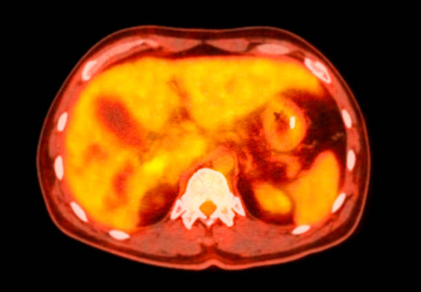 istock A PET CT scan image shows comprehensive views of organs and tissues. 2157644765