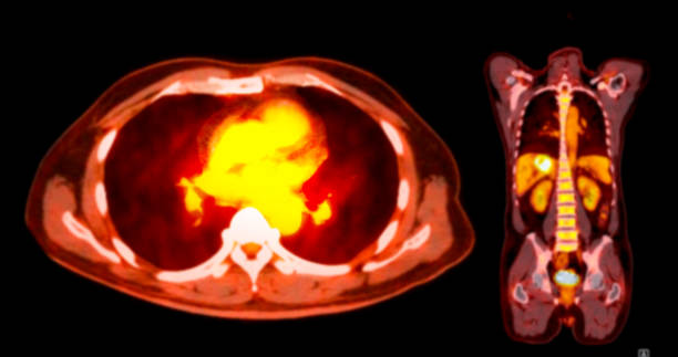 A PET CT scan image shows comprehensive views of organs and tissues.
