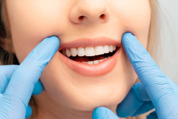 istock Teeth whitening procedure. Dental care. 2157814117