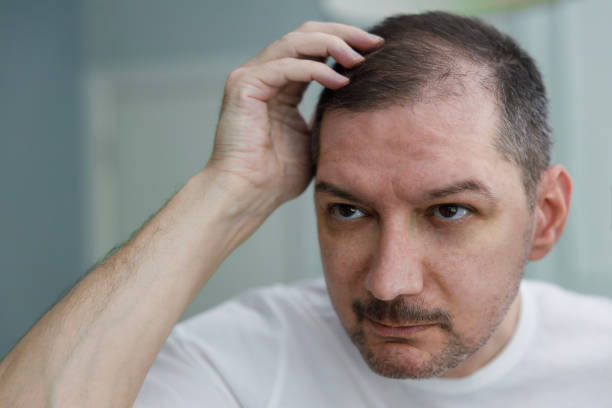 istock Middle aged man checking his bald spots in the mirror 2157845012