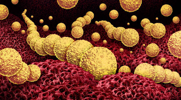 Flesh Eating Bacteria Flesh Eating Bacteria or flesh-eating bactrial infection as a dangerous outbreak of a rare disease as Necrotizing Fasciitis infecting the skin and flesh underneath as a deadly and life threatening illness. fournier gangrene stock pictures, royalty-free photos & images