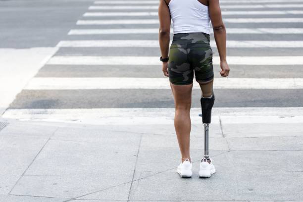istock Woman with prosthetic standing by the crosswalk 2158040605