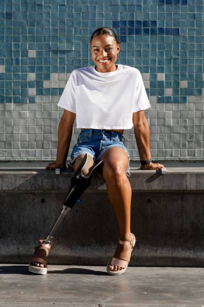 Confident amputee woman wearing white plain shirt, happy summer image