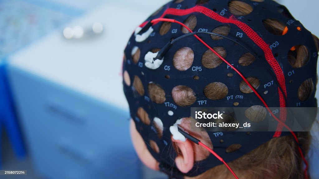 Brain Activity Testing Eeg Cap Is Weared To Provide Brain Activity Test Stock Photo - Download ...