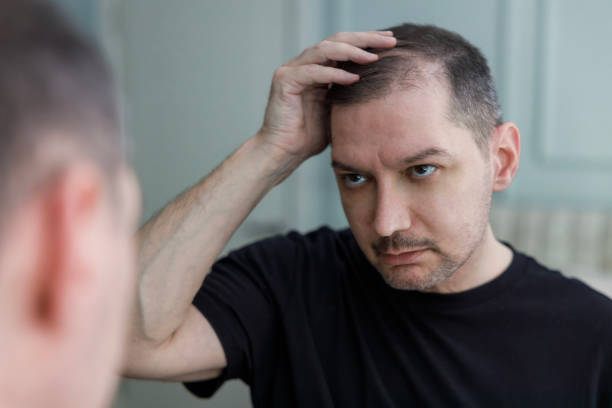 istock Middle aged man checking his bald spots in the mirror 2158115389