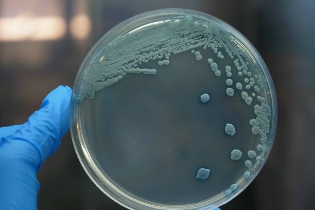 istock Trichosporon asahii on CHROMagar Candida 2158125362