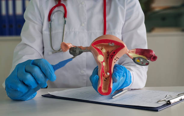 istock Doctor Explaining Female Reproductive System Model During Consultation 2158127353