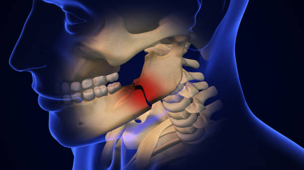 istock Broken Jaw joint with Metal Plate and Screws 2158363463