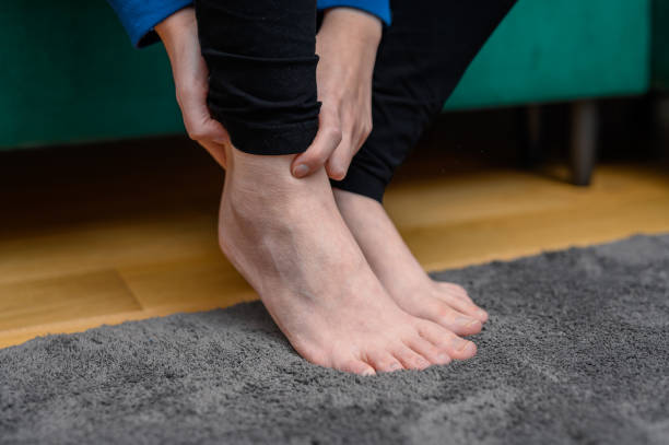 istock Swollen legs and feet, bare women's feet close up, touching 2158369616