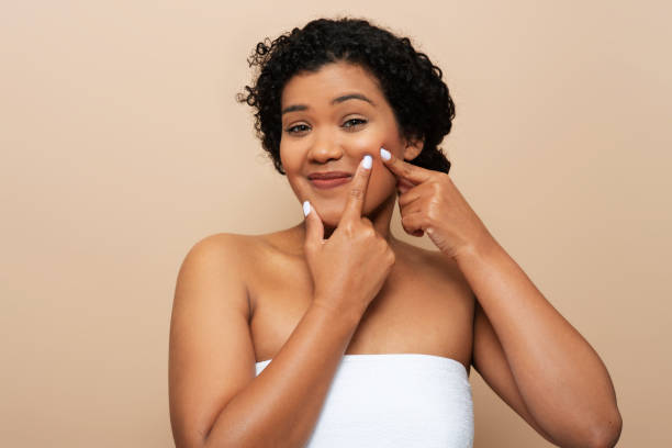 Young woman wrapped in towel squeezing pimples on her face
