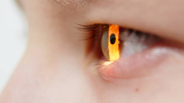 istock Examination of the child using a slit lamp. Microscope and focused light source. A device for high-precision examination of the eye to determine the condition of the lens. 2158392934