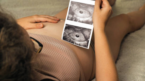 istock Expectant Parent with Ultrasound Scan 2158502878