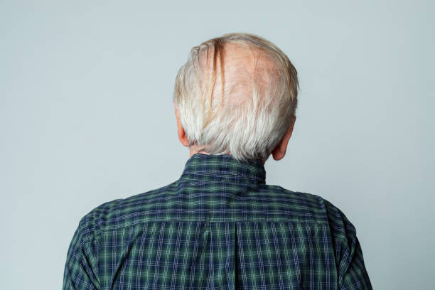 istock Rear view of a senior man crown balding 2158518114