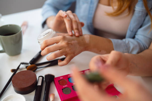 istock An unrecognizable woman with vitiligo testing new hand cream on her skin 2158548327