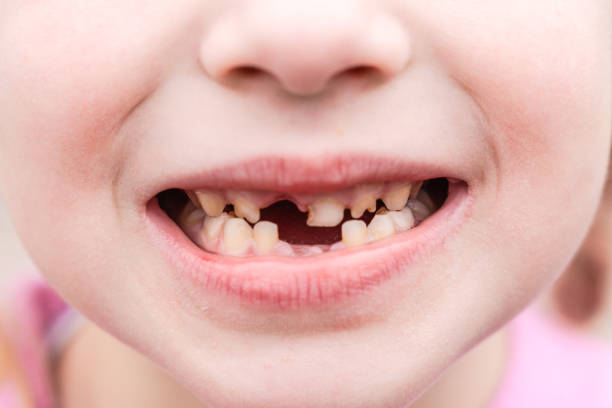 istock Kid shows off first missing tooth. Children without one tooth smiles 2158596188