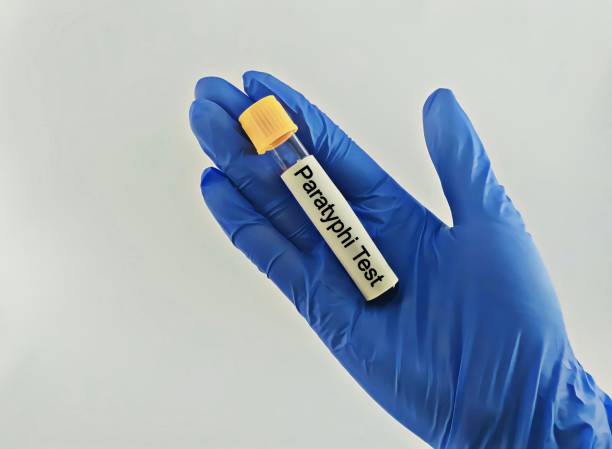 istock Diagnostician holding in hand Paratyphi test. Blood sample for Paratyphi test 2158600725