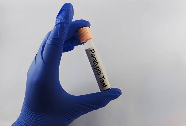 istock Diagnostician holding in hand Paratyphi test. Blood sample for Paratyphi test 2158600748