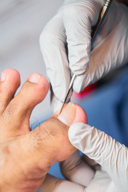 istock Podiatrist treating feet, concept chiropody 2158618186