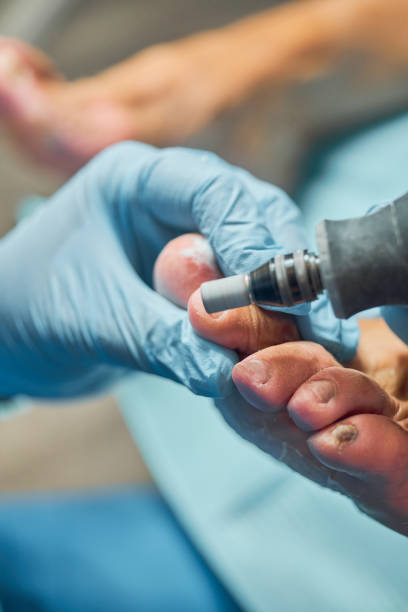 istock Chiropodist does a pedicure for the client's foot, cleaning the nails 2158618187