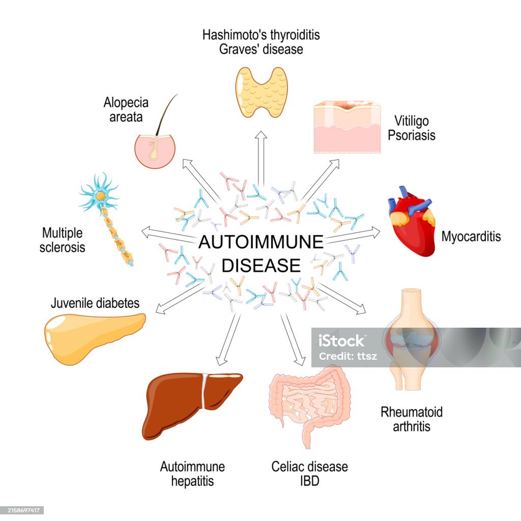 Autoimmunity Animation Autoimmune Disease Stock Illustration - Download Image Now - Hepatitis ...