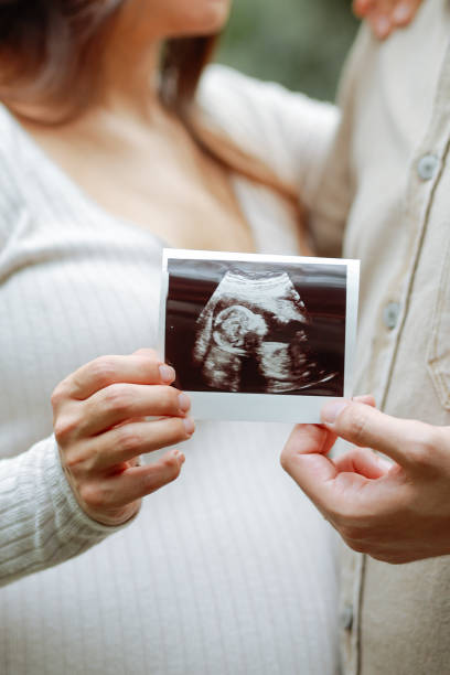 istock Pregnant woman with her husband 2158783593