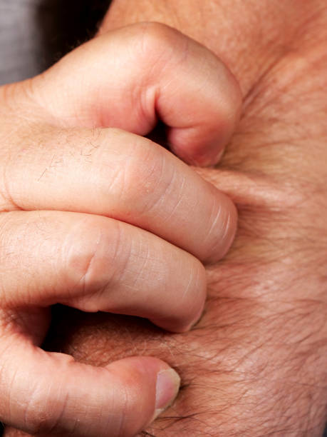 istock close-up a man scratches his arm 2158832903