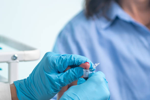 istock Nurse draws blood sample from patient's finger with finger prick method. 2158952258