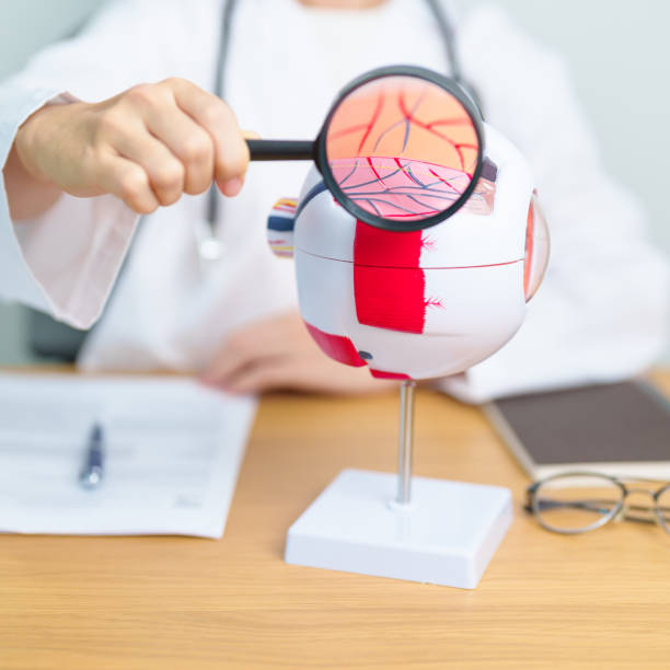 istock Doctor with human Eye anatomy model with magnifying glass. Eye disease, Refractive Errors, Age Related Macular Degeneration, Cataract, Diabetic Retinopathy, Glaucoma, Amblyopia, Strabismus and Health 2159109628