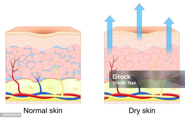 Normal Skin Progress Notes Dry And Normal Human Skin Stock Illustration - Download Image Now ...