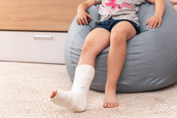 istock A child with a broken leg in a cast sits in a bean bag chair 2159183693